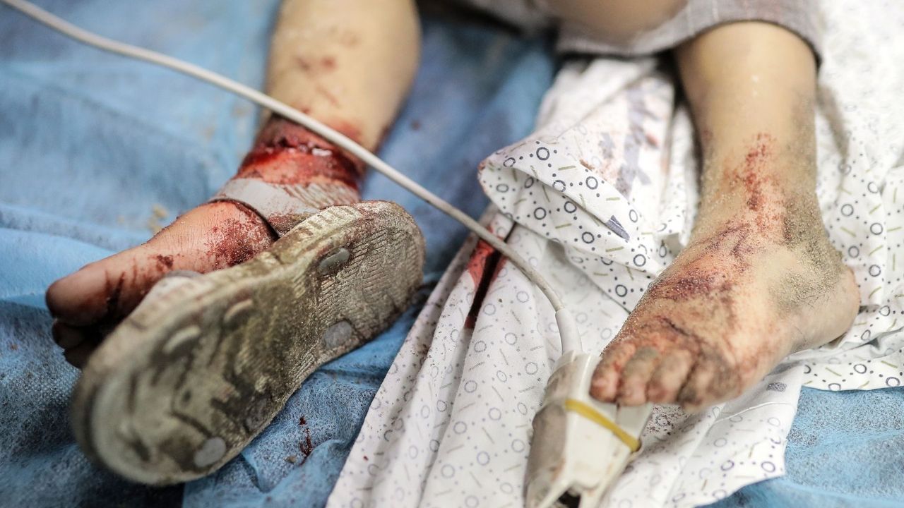 Gazze Şeridi Hastaneler Genel Müdürlüğü: Şifa Hastanesi'nde 36'sı çocuk 650 hastanın hayatı tehlikede 