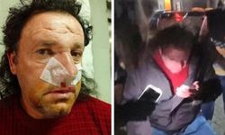 Büyükçekmece'de site yönetimi kavgası: Bir kişinin burnu kırıldı