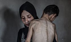 Gazze'de açlıktan ölenlerin sayısı 94'ü çocuk 188'e yükseldi