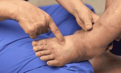 Dizde Ödem ve Şişlik Sorunlarında Erken Müdahale Büyük Önem Taşıyor!