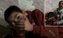 Kümeste tutulan engelli çocuk bakanlığın himayesi altına alındı