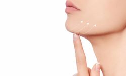 Gıdı Eritme Nedir? Yüz Estetiğindeki Önemi