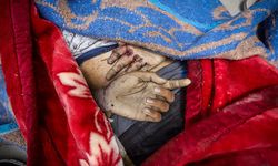 “Gazze'de can kaybı bildirilenden çok daha yüksek”