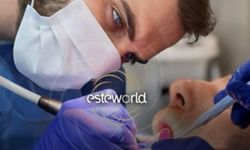 Diş Beyazlatma: Fiyatlar ve Esteworld’de Daha Beyaz Bir Gülüşün Sırları