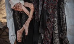 Soykırım davasına müdahil Hollanda: Gazze'de açlık ve insani yardıma engel, soykırım kastının ispatında önemli