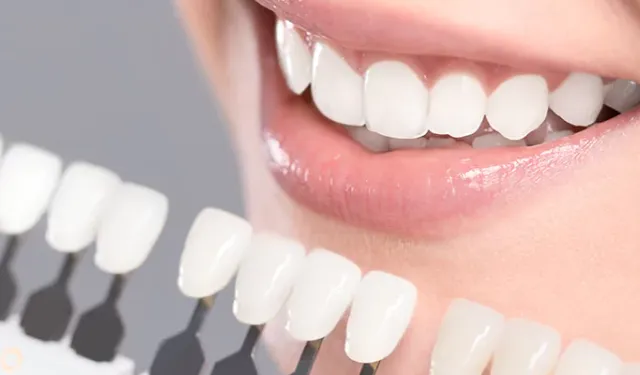 Gülüş Tasarımı ve Zirkonyum Kaplama: Kusursuz Bir Gülüş İçin Modern Yaklaşımlar