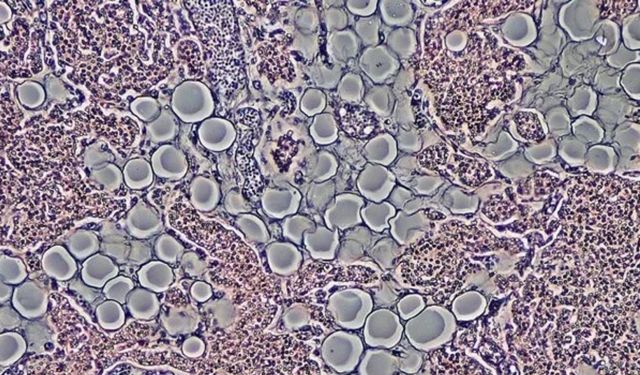 Laboratuvarda ilk canlı insan derisi geliştirildi