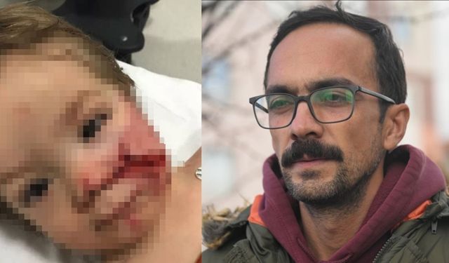 Ankara'da pitbull saldırısına uğrayan çocukların babası, sorumluların cezalandırılması çağrısında bulundu
