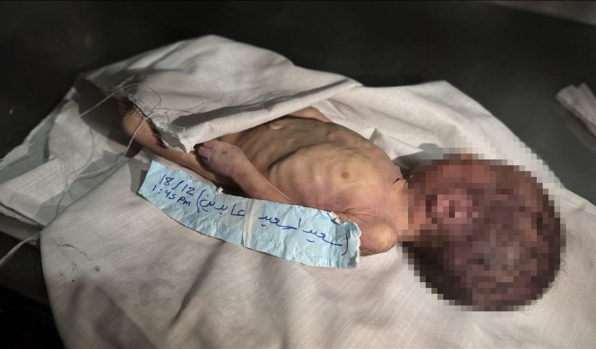 Gazze'de şiddetli soğuk nedeniyle bir aylık bebek şehit oldu