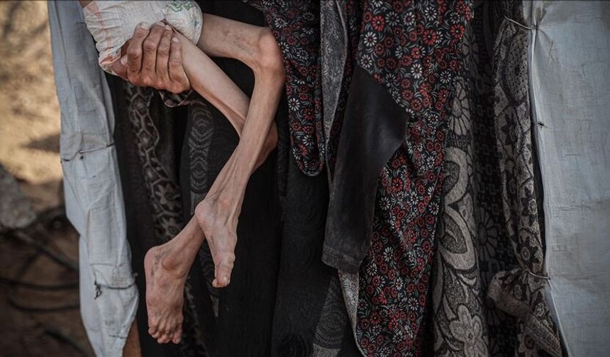 Soykırım davasına müdahil Hollanda: Gazze'de açlık ve insani yardıma engel, soykırım kastının ispatında önemli